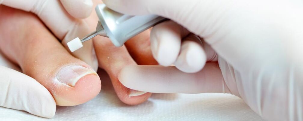 therapeutic manicure for toe fungus
