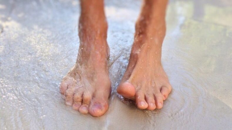 fungus infection
