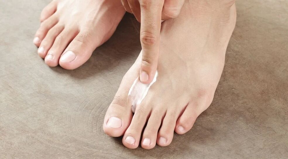 Applying the fungus cream between your fingers