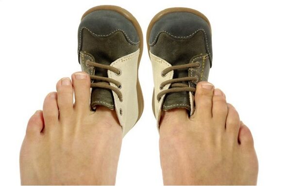 how to recognize nail fungus by symptoms